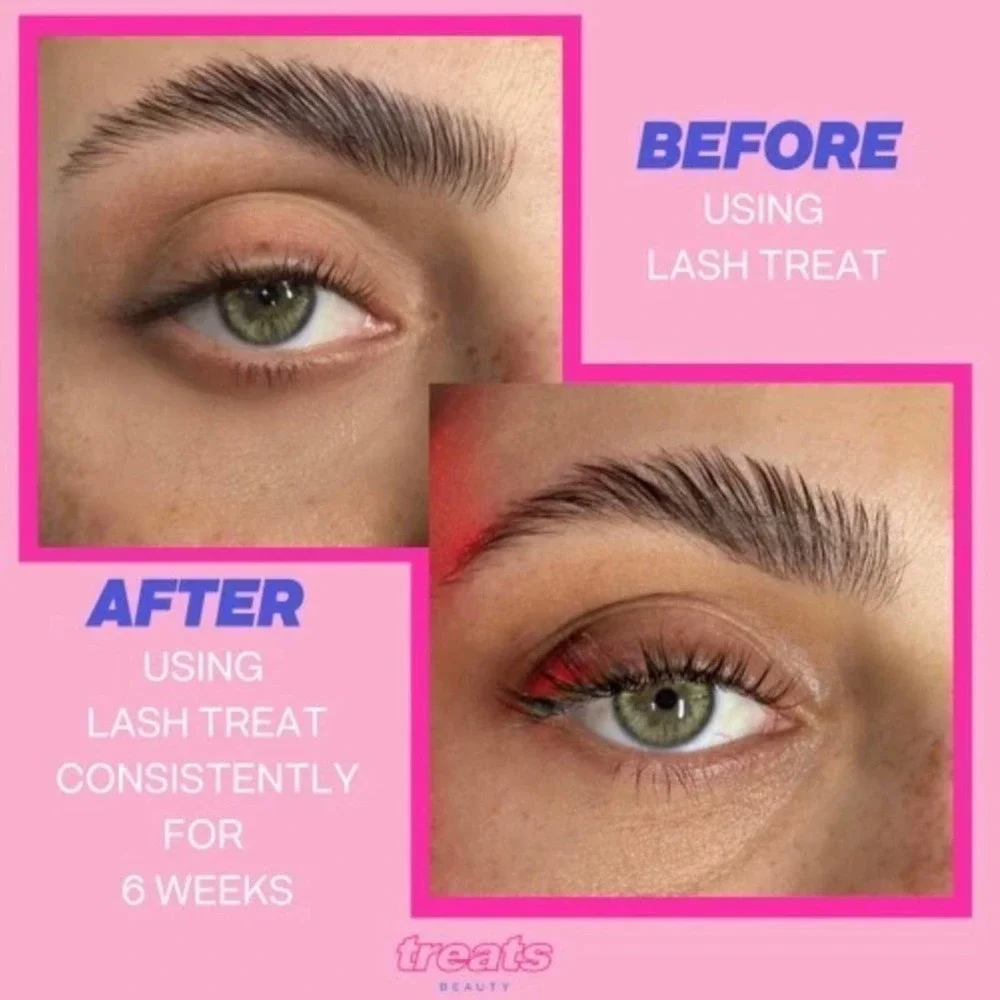 Lash Treat Full Size Rose Infused Lash Serum